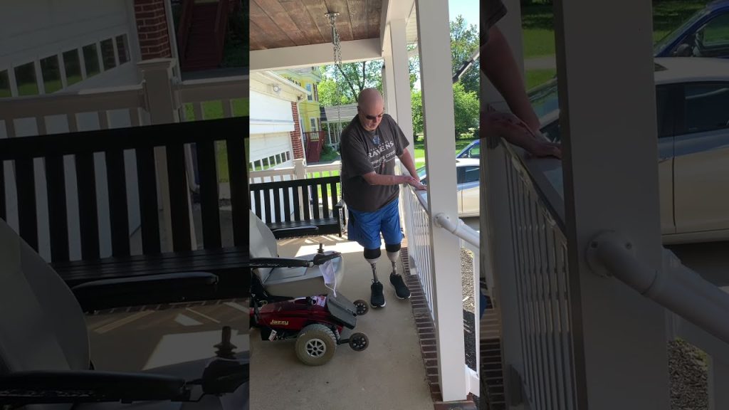 TRIPLE AMPUTEE teaching myself to walk again. FIRST STEPS